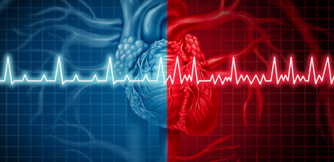 ekg